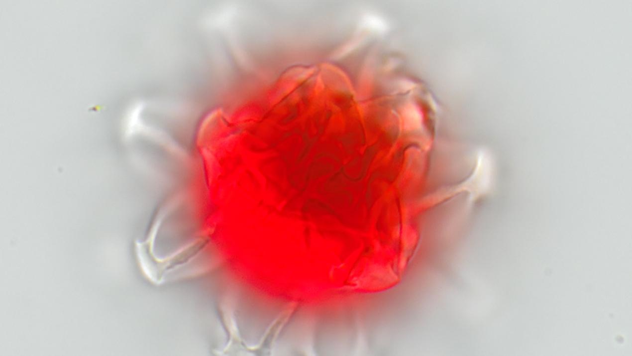 alge snøalge sett i mikroskop. Foto